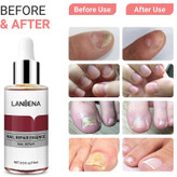 سرم ترمیم کننده ناخن لنبنا مدل REPAIR ESSENCE حجم 15 میلی لیتر