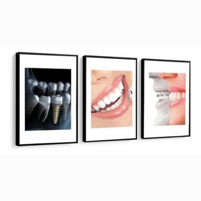 تابلو مدل مطب دندانپزشکی کد 23 مجموعه 3 عددی